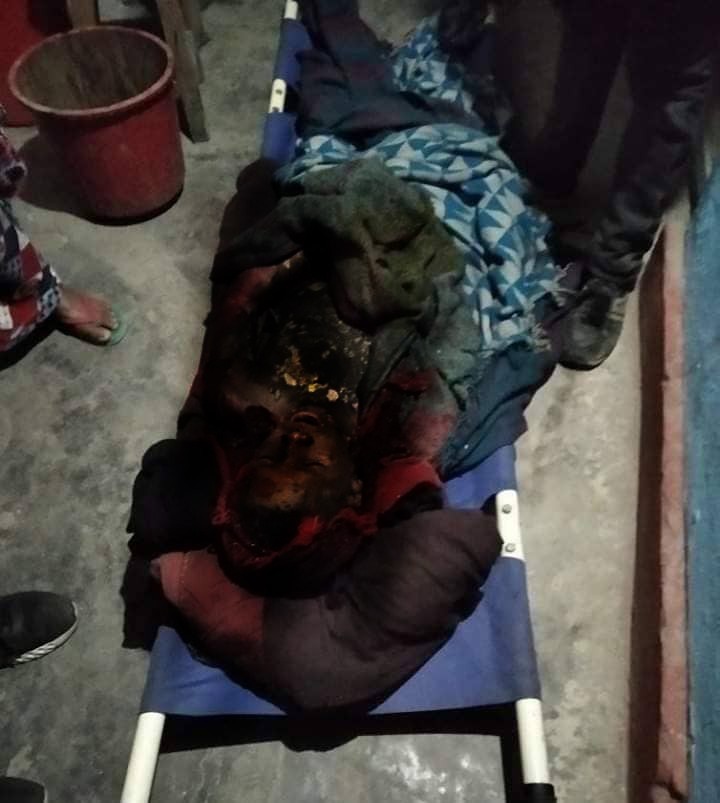 बाजुरामा आगो नियन्त्रण गर्न खोज्दा जलेर १ जनाको मृत्यु