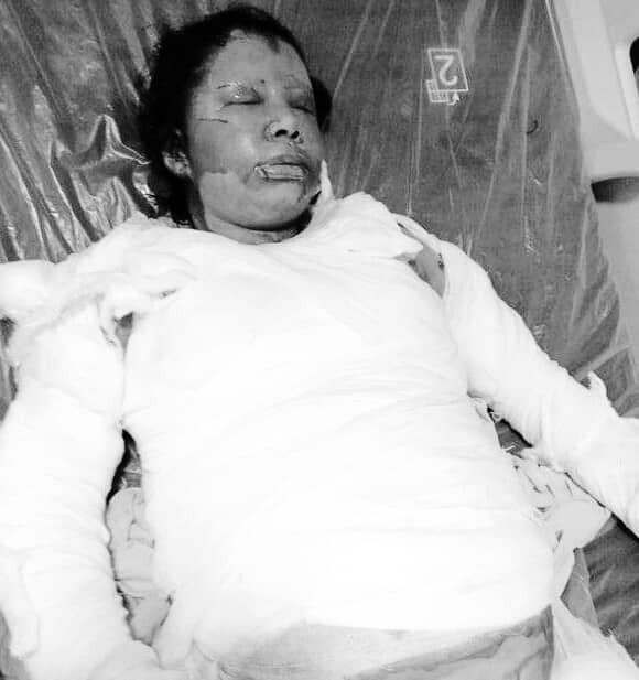 खाना पकाउने क्रममा स्टोभ पड्किदा भारतमा एक नेपाली महिलाको मृत्यु