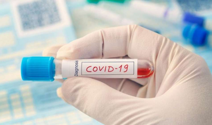 सुदूरपश्चिममा  एकै दिन २४ जनामा कोरोना पुष्टि