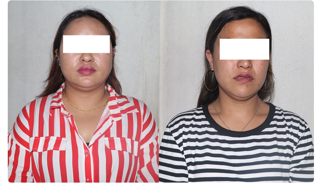 'हनी ट्रयाप’ गरेर फसाउँदै हिन्ने कैलाली को गोदावरीकी तामाङ सहित २ महिला पक्राउ